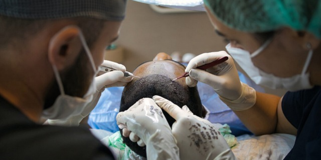 Hair Transplant Clinic in Chandigarh