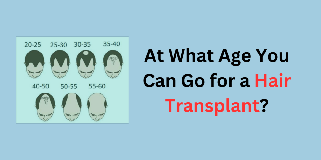 Male hair Transplant
At What Age You Can Go for a Hair Transplant?